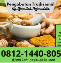 Pengobatan Alternatif