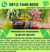 Pengobatan Hepatitis