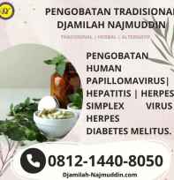 Pengobatan Tradisiona