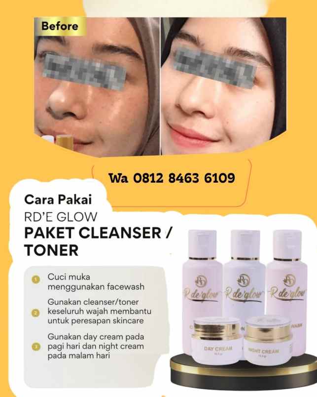 produk perawatan semarang barat