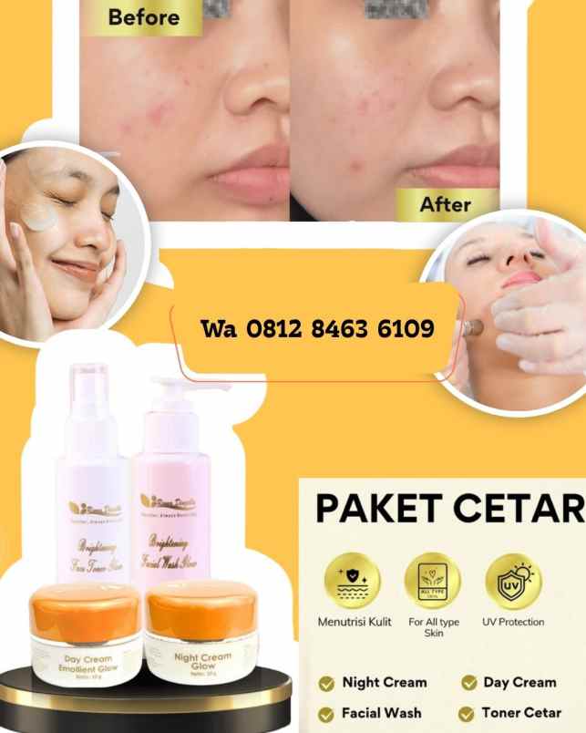 produk perawatan sragen