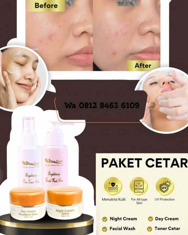produk perawatan rembang