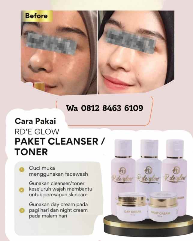 produk perawatan indramayu