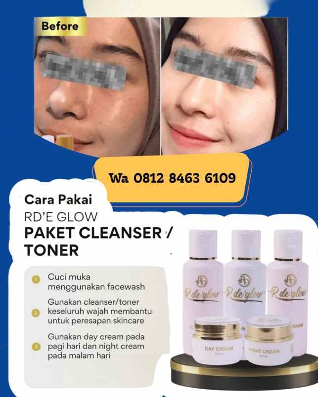 produk perawatan laweyan